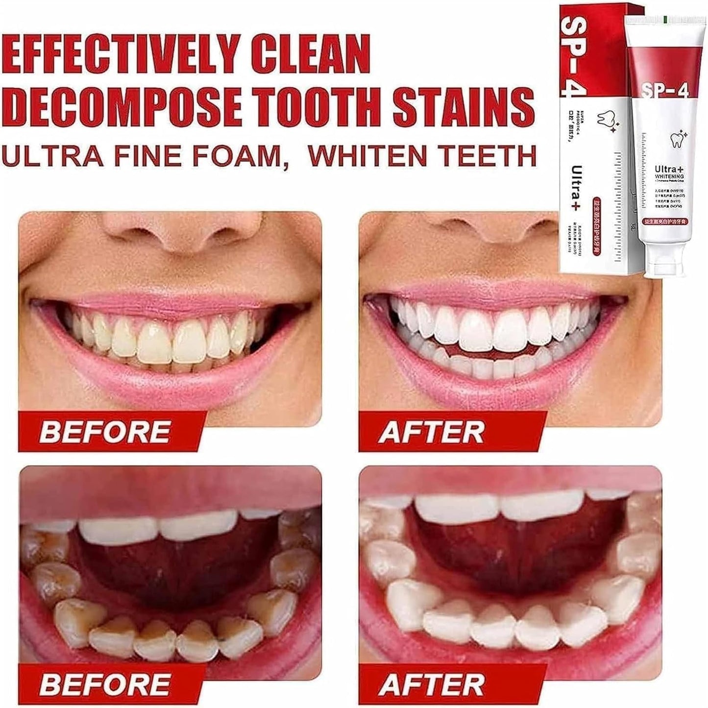 Yayashi Sp-4 Ultra Whitening Toothpaste Probiotic Stain Remover / Stain Removing Toothpaste